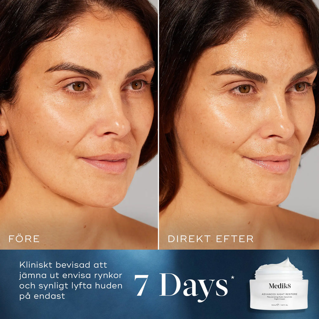 Före- och efterbild av en kvinna som visar effekten av Medik8 Advanced Night Restore nattkräm. Hennes hud ser jämnare och mer återfuktad ut efter användning. Text på bilden beskriver produktens kliniskt bevisade effekt på rynkor och hudlyft inom sju dagar.