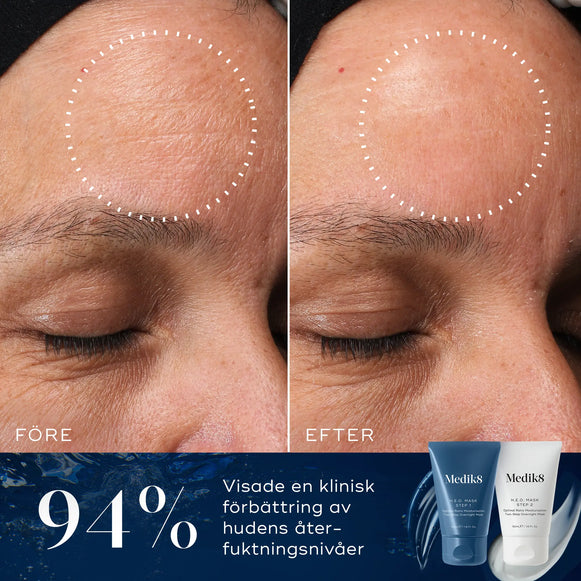 Före- och efterbild av en panna, där förbättringar i återfuktningsnivåer syns efter användning av H.E.O. Mask, med 94% förbättring indikerad.-hover-9