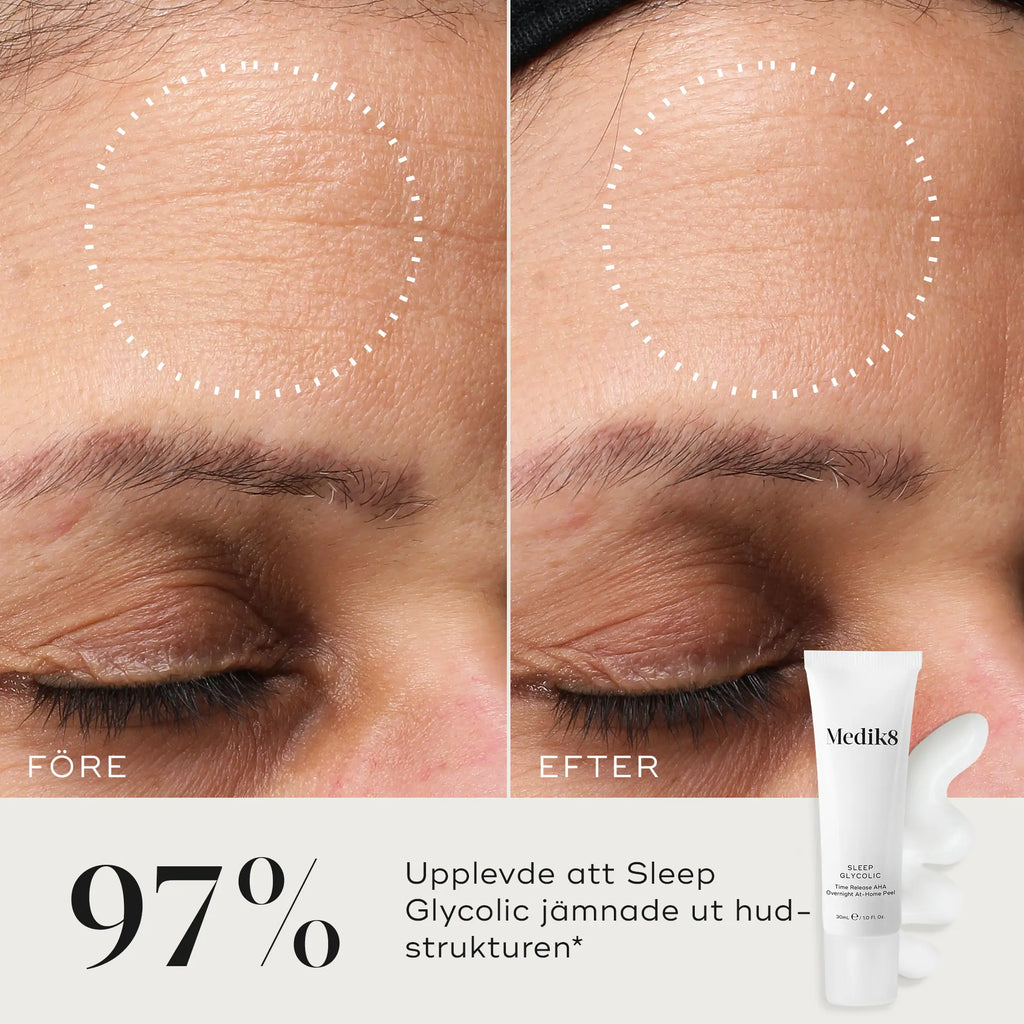 Före- och efterbild som visar förbättringar av hudytan efter användning av Medik8 Sleep Glycolic, med 97% som upplever en slätare hud.