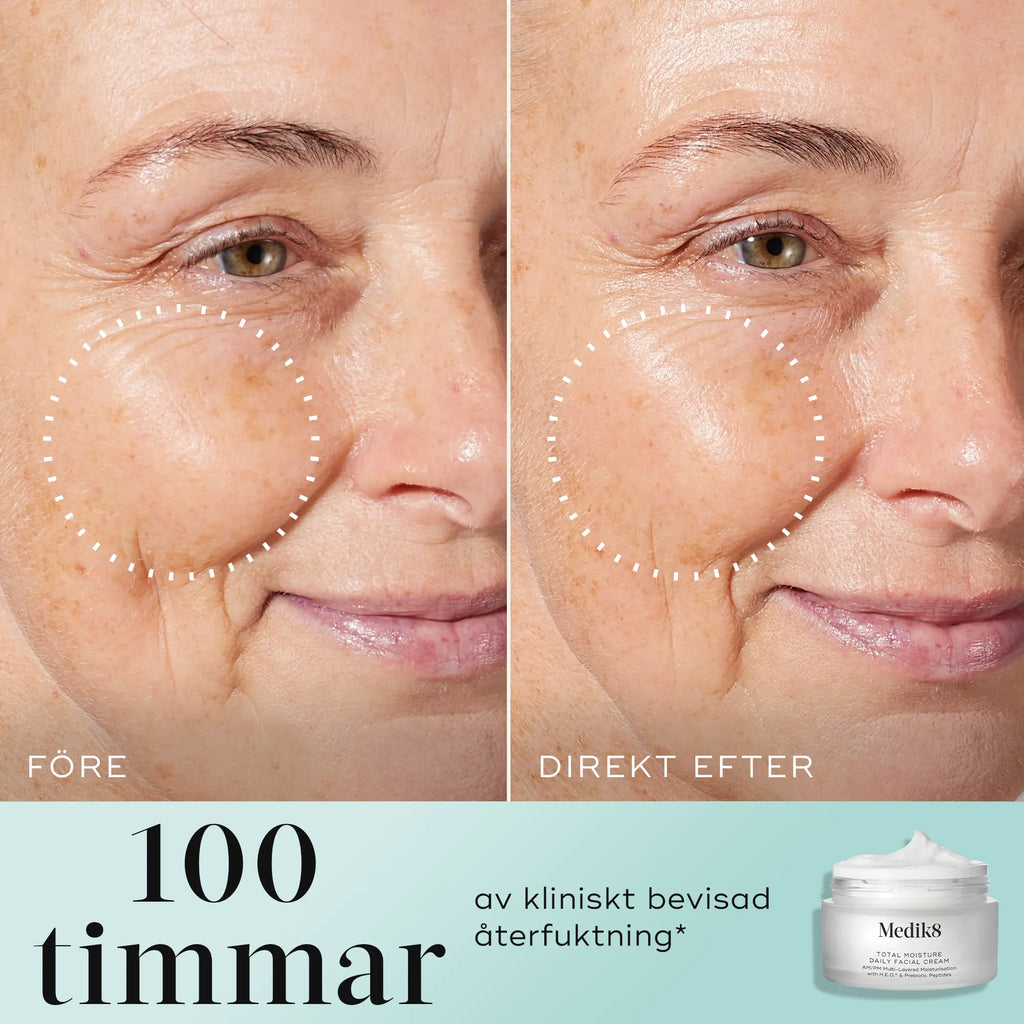Före- och efterbild som visar effekten av Medik8 Total Moisture Daily Facial Cream på huden, med text om 100 timmars återfuktning.