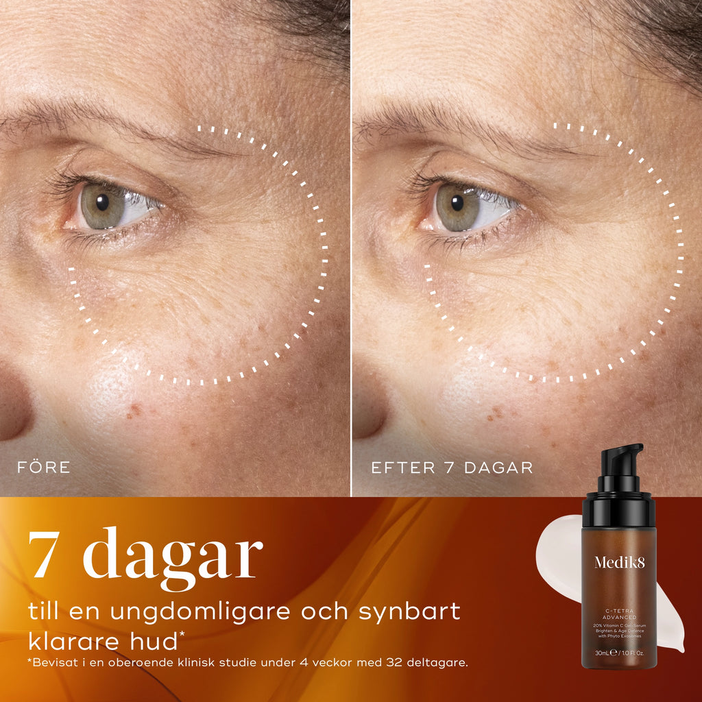 Före- och efterbild som visar synbart jämnare hudstruktur och färre rynkor efter 7 dagar med Medik8 C-Tetra Advanced.