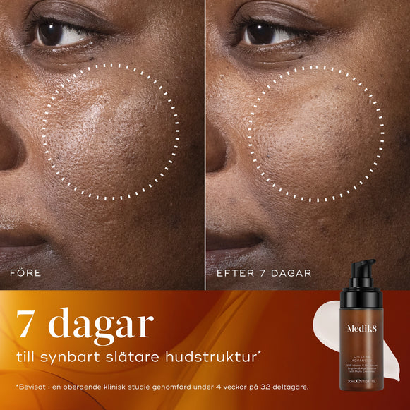 Före- och efterbild som visar förbättrad hudstruktur och klarare hud på mörkare hudton efter 7 dagars användning av C-Tetra Advanced.-hover-3