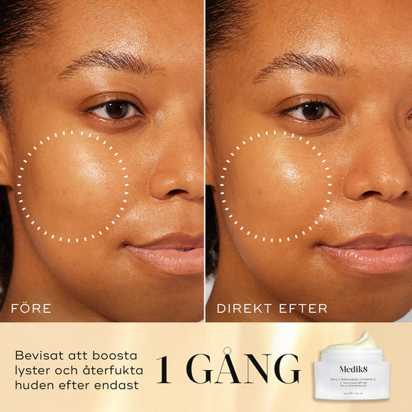 Före- och efterbild av en kvinnas kind som visar ökad lyster och återfuktning efter en applicering av Medik8 Daily Radiance Vitamin C. En burk med produkten syns längst ner i bilden.-hover-5