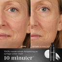 Före- och efterbild som visar effekten av Medik8 Liquid Peptides Advanced MP på en kvinnas hud efter 10 minuter. Områden med minskade rynkor är markerade med streckade cirklar. Texten framhäver den kliniska förbättringen inom kort tid.