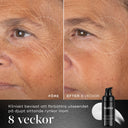 Före- och efterbild som visar hur Medik8 Liquid Peptides Advanced MP har minskat djupa rynkor efter 8 veckor. Streckade cirklar markerar områden med förbättring. Texten lyfter fram de kliniska resultaten.