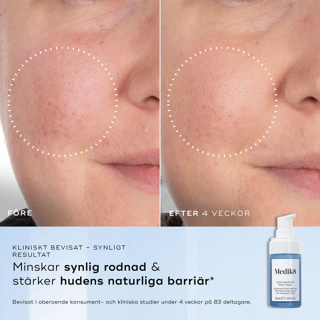 Niacinamide Peptides™