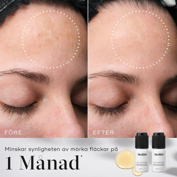 Före- och efterbild som visar resultatet av Medik8 Oxy-R Peptides på mörka fläckar i ansiktet, med märkbar skillnad efter en månads användning.-hover-36