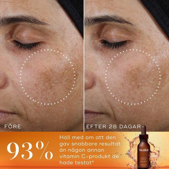 Före- och efterbild som visar resultatet av användning av Medik8 Super C Ferulic, med text om att 93% av deltagarna tyckte att produkten fungerade snabbare än andra C-vitaminprodukter.-hover-7