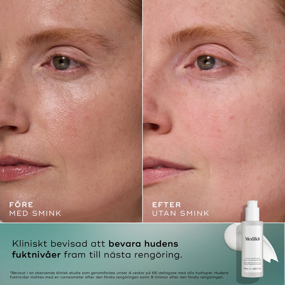 Total Moisture Daily Cleansing Gel-hover-50